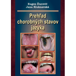 Prehľad chorobných stavov jazyka
