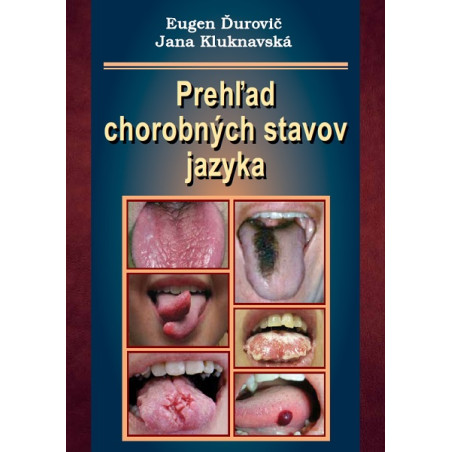 Prehľad chorobných stavov jazyka