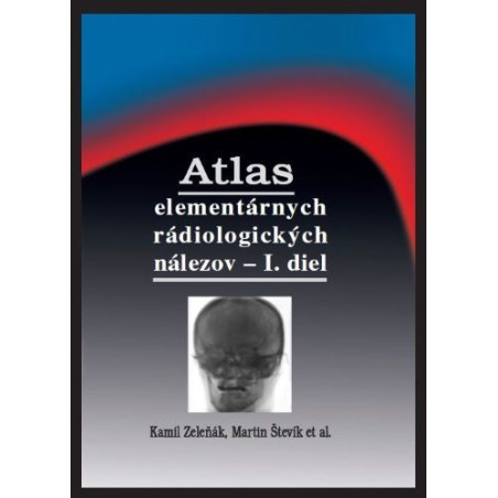 Atlas elementárnych rádiologických nálezov - I. diel (2.vydanie)