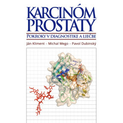 Karcinóm prostaty