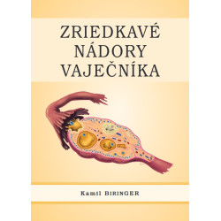 Zriedkavé nádory vaječníka