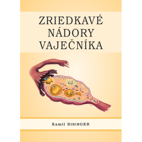 Zriedkavé nádory vaječníka