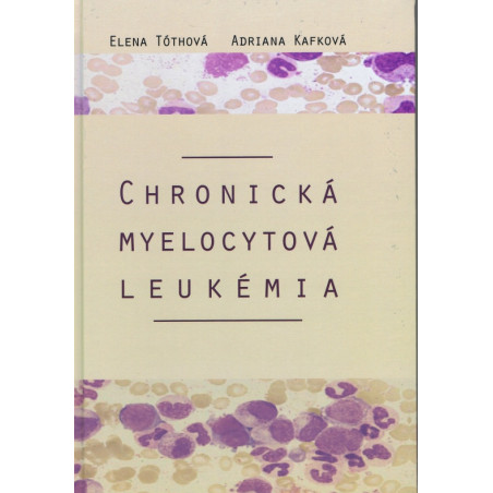 Chronická myelocytová leukémia