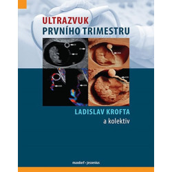 Ultrazvuk prvního trimestru