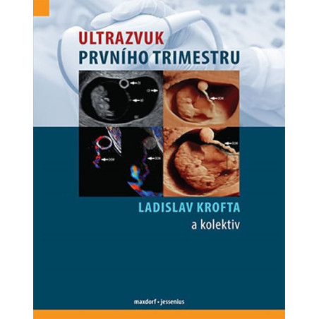 Ultrazvuk prvního trimestru