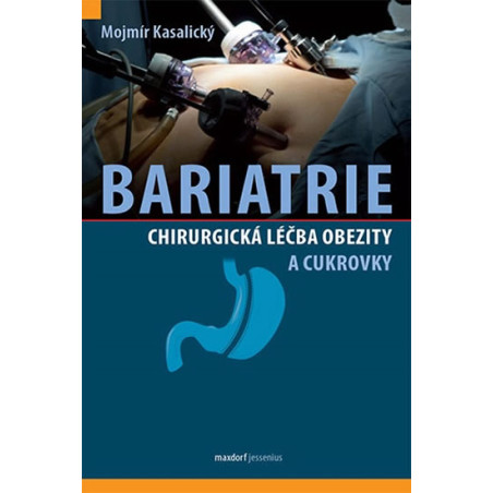 Bariatrie - Chirurgická léčba obezity a cukrovky