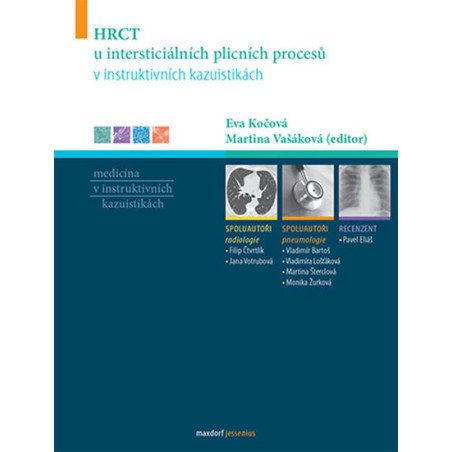HRCT u intersticiálních plicních procesů v instruktivních kazuistikách