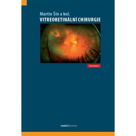 Vitreoretinální chirurgie