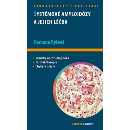 Systémové amyloidózy a jejich léčba