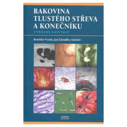 Rakovina tlustého střeva a konečníku - vybrané kapitoly