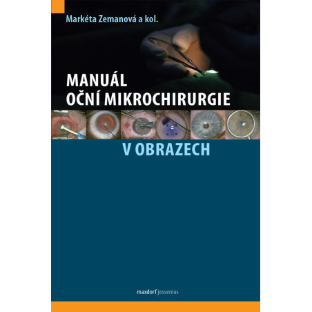Manuál oční mikrochirurgie v obrazech