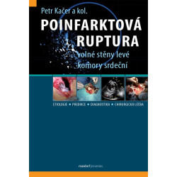 Poinfarktová ruptura volné stěny levé komory srdeční