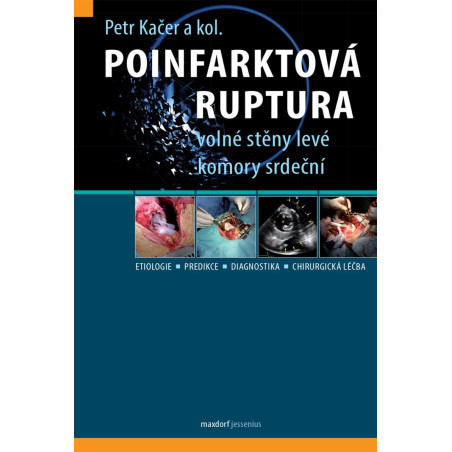 Poinfarktová ruptura volné stěny levé komory srdeční