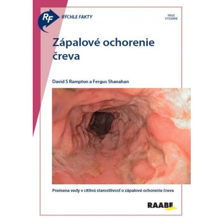 Rýchle fakty: Zápalové ochorenie čreva