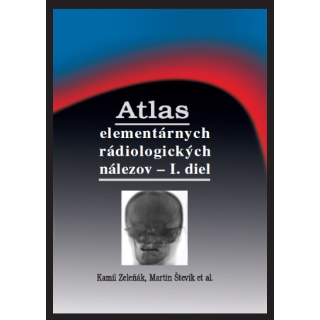 Atlas elementárnych rádiologických nálezov - I. diel