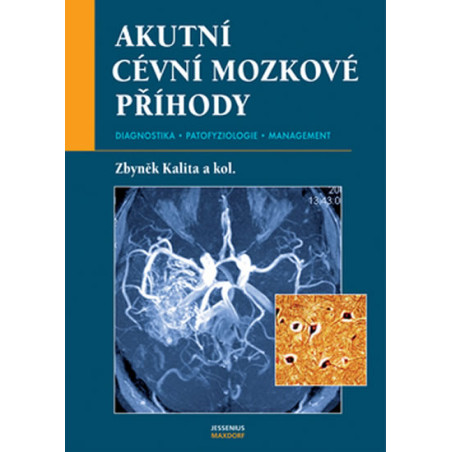 Akutní cévní mozkové příhody