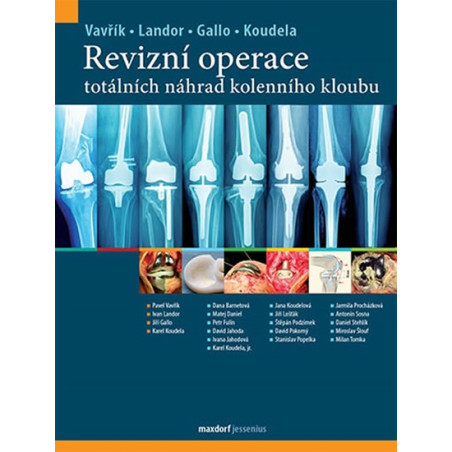 Revizní operace totálních náhrad kolenní