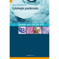 Cytologie pankreatu - Manuál EUS-FNA on site