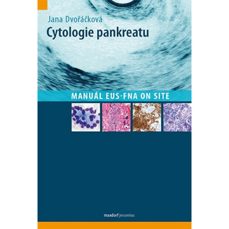 Cytologie pankreatu - Manuál EUS-FNA on site