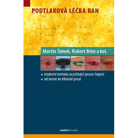 Podtlaková léčba ran