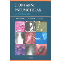 Spontánní pneumotorax