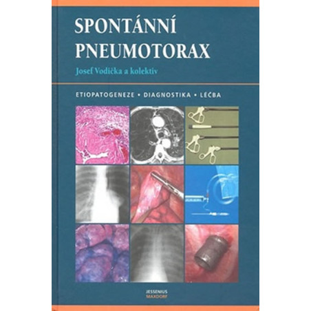 Spontánní pneumotorax
