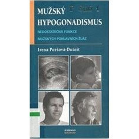 Mužský hypogonadismus - Nedostatečná funkce mužských pohlavních žláz