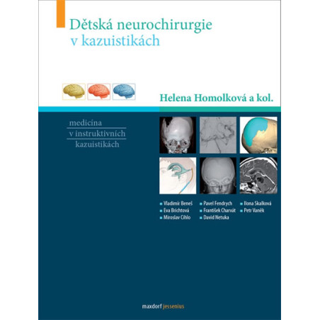 Dětská neurochirurgie v kazuistikách