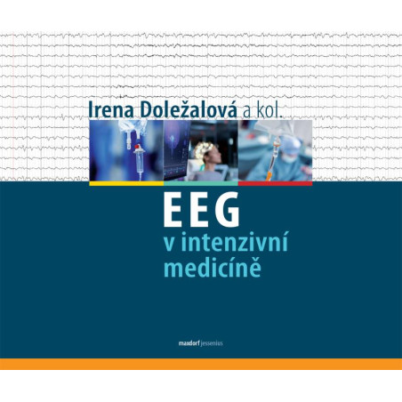 EEG v intenzivní medicíně