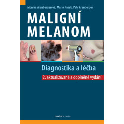 Maligní melanom - Diagnostika a léčba