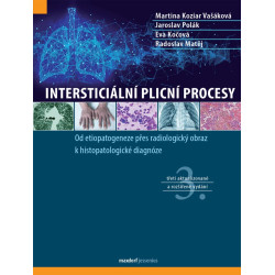 Intersticiální plicní procesy