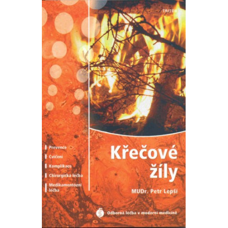 Křečové žíly