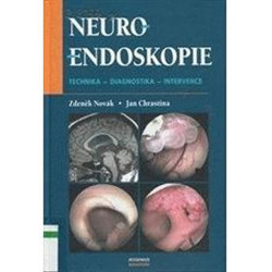 Neuroendoskopie