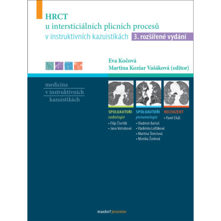 HRCT u intersticiálních plicních procesů v instruktivních kazuistikách