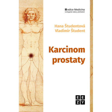 Karcinom prostaty