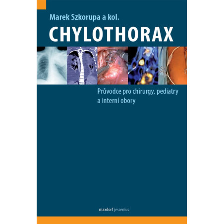 Chylothorax - Průvodce pro chirurgy, pediatry a interní obory