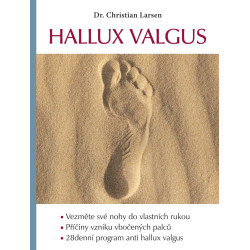 Hallux valgus