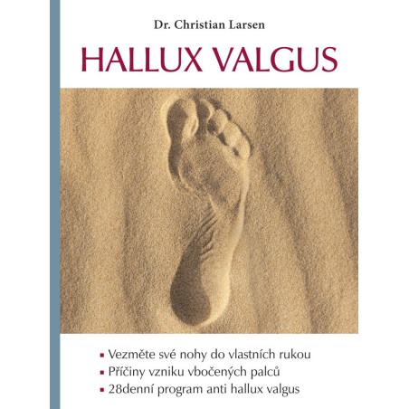 Hallux valgus