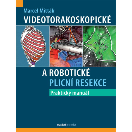 Videotorakoskopické a robotické plicní resekce