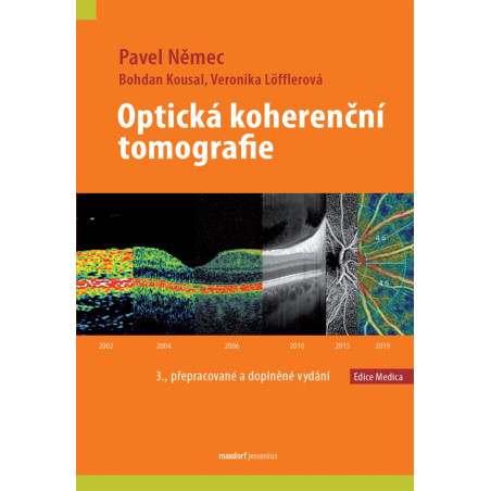 Optická koherenční tomografie