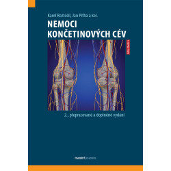 Nemoci končetinových cév