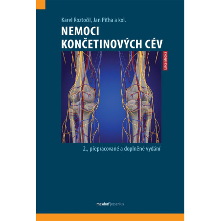 Nemoci končetinových cév