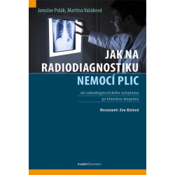 Jak na radiodiagnostiku nemocí plic