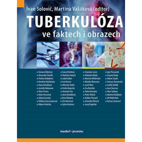 Tuberkulóza ve faktech i obrazech