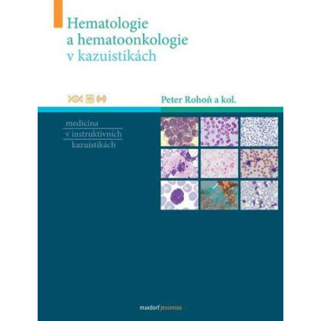 Hematologie a hematoonkologie v kazuisti