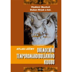 Atlas léčby onemocnění temporomandibulárního kloubu
