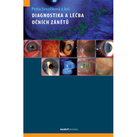 Diagnostika a léčba očních zánětů