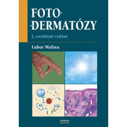 Fotodermatózy