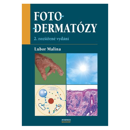 Fotodermatózy