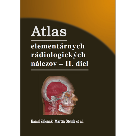 Atlas elementárnych rádiologických nálezov - II. diel